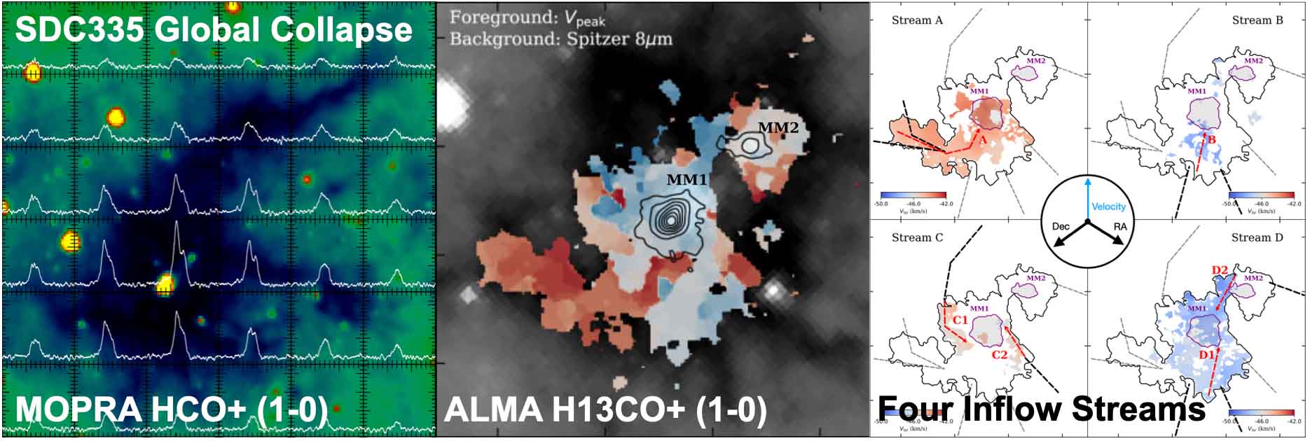 Large-scale collapse and four ALMA filamentary inflow streams in SDC335